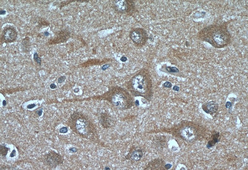 Immunohistochemistry of paraffin-embedded human brain tissue slide using Catalog No:110582(FAM19A5 Antibody) at dilution of 1:50 (under 40x lens)