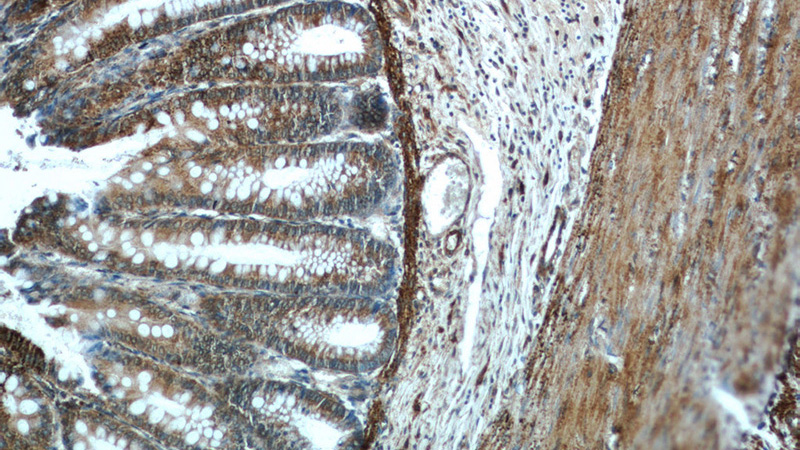 Immunohistochemistry of paraffin-embedded human colon tissue slide using Catalog No:114544(RANKL Antibody) at dilution of 1:50 (under 10x lens)
