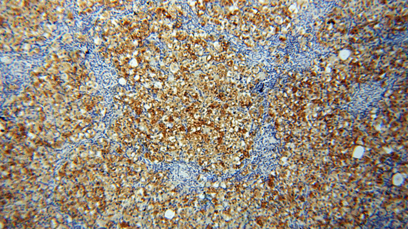 Immunohistochemical of paraffin-embedded human ovary using Catalog No:109488(PTGS2 antibody) at dilution of 1:50 (under 10x lens)
