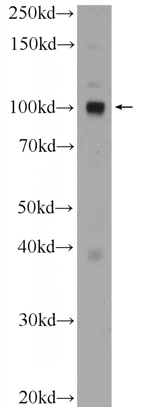 HeLa cells were subjected to SDS PAGE followed by western blot with Catalog No:109623(CTAGE6 Antibody) at dilution of 1:600