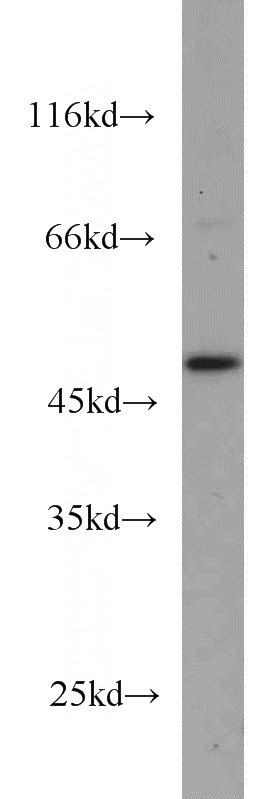 HL-60 cells were subjected to SDS PAGE followed by western blot with Catalog No:110843(GALK2 antibody) at dilution of 1:500
