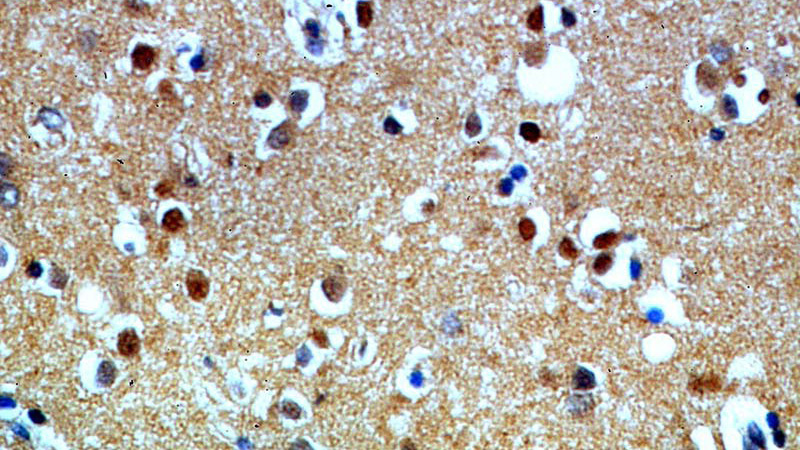 Immunohistochemical of paraffin-embedded human brain using Catalog No:109396(CLN3 antibody) at dilution of 1:50 (under 40x lens)