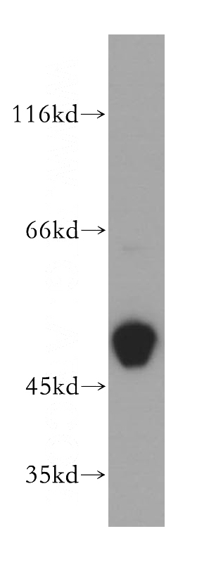 human skeletal muscle tissue were subjected to SDS PAGE followed by western blot with Catalog No:109331(CKMT2 antibody) at dilution of 1:800