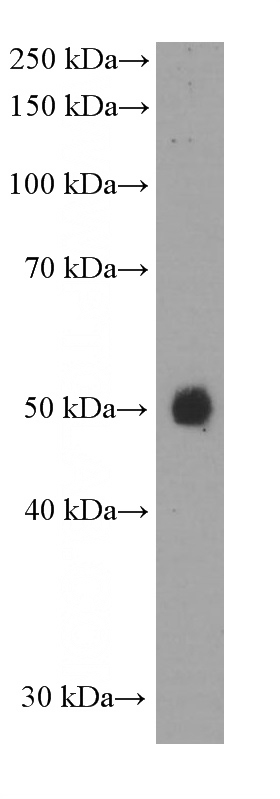 human skeletal muscle tissue were subjected to SDS PAGE followed by western blot with (PD-L1/CD274 Antibody) at dilution of 1:1000