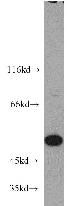 HepG2 cells were subjected to SDS PAGE followed by western blot with Catalog No:107497(RBBP4 antibody) at dilution of 1:1000