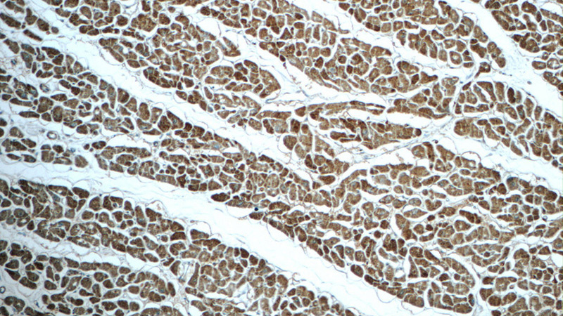 Immunohistochemistry of paraffin-embedded human heart tissue slide using Catalog No:111251(GUCY2F Antibody) at dilution of 1:50 (under 10x lens)