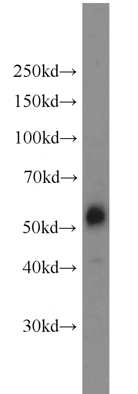 HeLa cells were subjected to SDS PAGE followed by western blot with Catalog No:111891(JNK antibody) at dilution of 1:1000