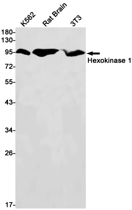 Western blot detection of Hexokinase 1 in K562,Rat Brain,3T3 cell lysates using Hexokinase 1 Rabbit pAb(1:1000 diluted).Predicted band size:103kDa.Observed band size:103kDa.