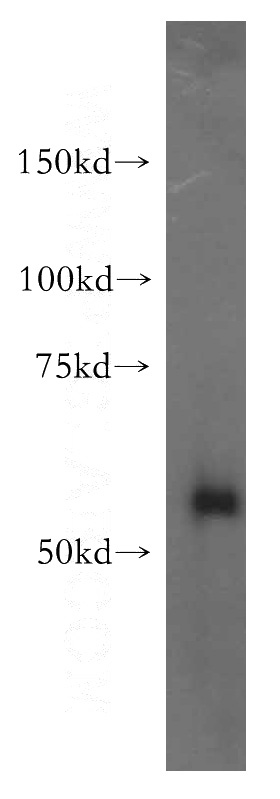 human liver tissue were subjected to SDS PAGE followed by western blot with Catalog No:116993(XPNPEP3 antibody) at dilution of 1:500