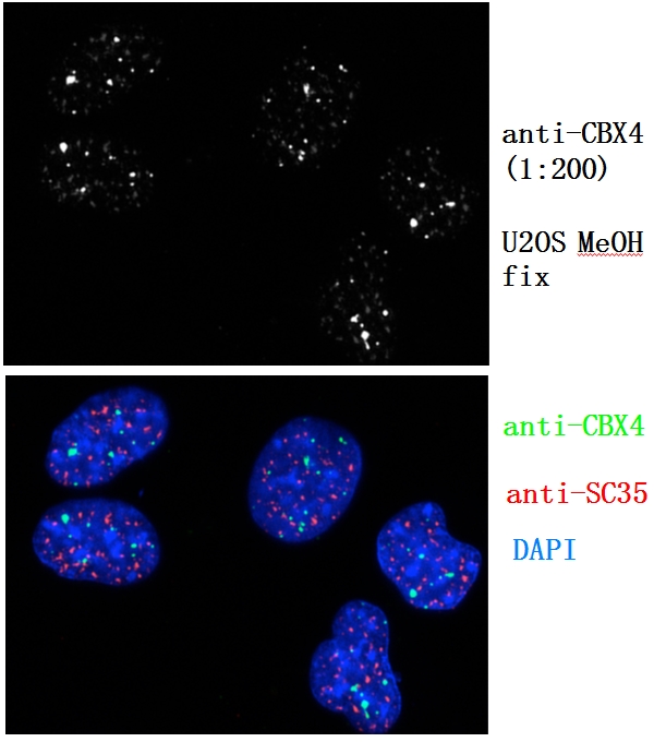 IF result of anti-CBX4 (Catalog No:108946, 1:200) with U2OS cell, MeOH fixation. (Courtesy of L. Pirone and R. Barrio, CIC bioGUNE).