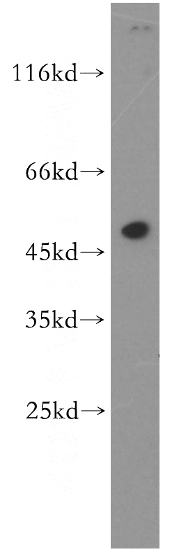human brain tissue were subjected to SDS PAGE followed by western blot with Catalog No:115936(TEKT1 antibody) at dilution of 1:500