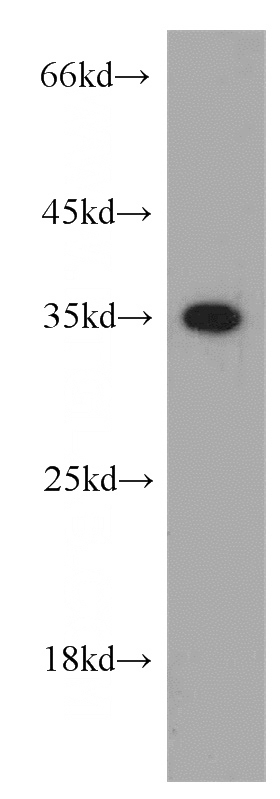 K-562 cells were subjected to SDS PAGE followed by western blot with Catalog No:108089(ANXA1 antibody) at dilution of 1:300