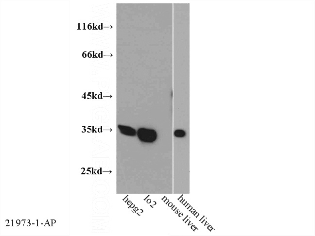 WB result of Catalog No:110954(GFRA2 antibody).