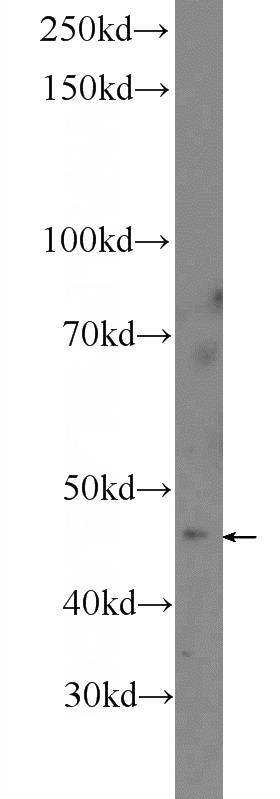 HEK-293 cells were subjected to SDS PAGE followed by western blot with Catalog No:108272(ASTL Antibody) at dilution of 1:300