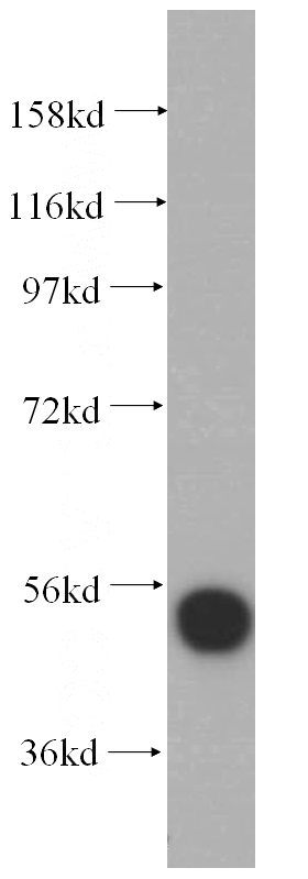 HEK-293 cells were subjected to SDS PAGE followed by western blot with Catalog No:114927(RRP1 antibody) at dilution of 1:500