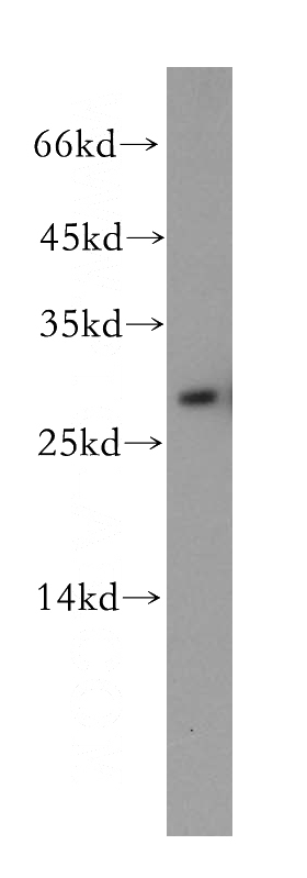 mouse brain tissue were subjected to SDS PAGE followed by western blot with Catalog No:116211(TPPP antibody) at dilution of 1:500