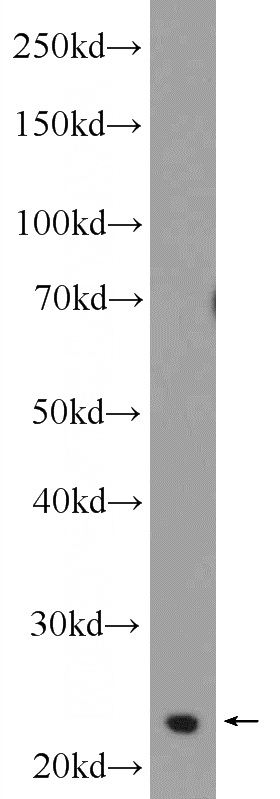 MCF-7 cells were subjected to SDS PAGE followed by western blot with Catalog No:116212(TPPP Antibody) at dilution of 1:1000
