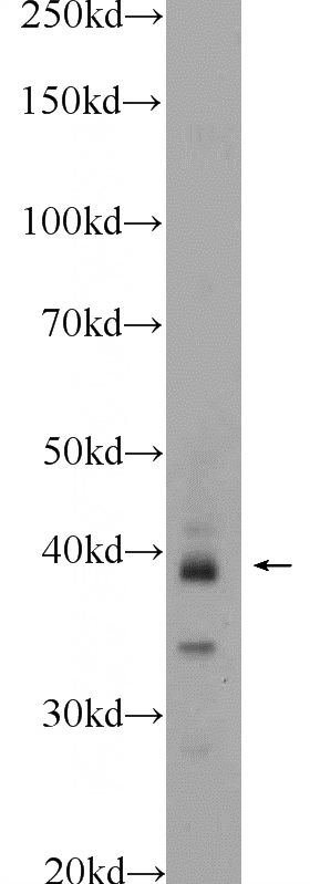 mouse testis tissue were subjected to SDS PAGE followed by western blot with Catalog No:116818(WDR92 Antibody) at dilution of 1:300