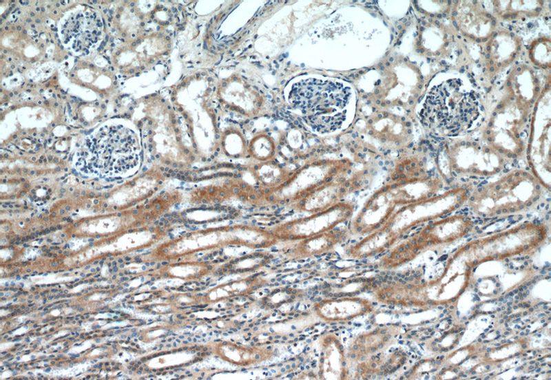 Immunohistochemical of paraffin-embedded human kidney using Catalog No:109693(CYP2D6 antibody) at dilution of 1:50 (under 10x lens)