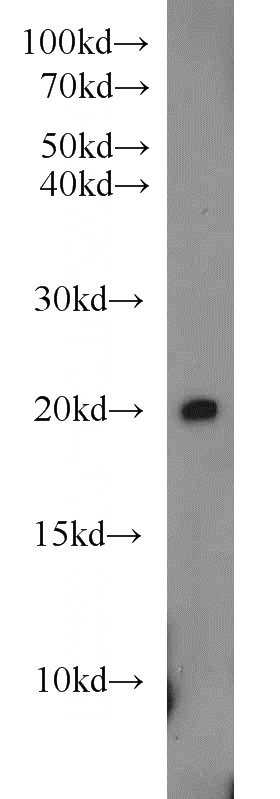 rat pancreas tissue were subjected to SDS PAGE followed by western blot with Catalog No:112663(MIXL1 antibody) at dilution of 1:500