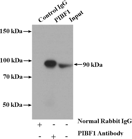 IP Result of anti-PIBF1 (IP:Catalog No:113885, 4ug; Detection:Catalog No:113885 1:500) with HEK-293 cells lysate 1120ug.