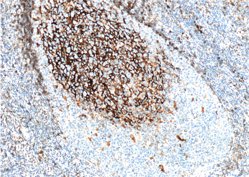 Immunohistochemistry of paraffin-embedded human tonsillitis tissue slide using Catalog No:109011(CD23,FCER2 Antibody) at dilution of 1:200 (under 10x lens). heat mediated antigen retrieved with Tris-EDTA buffer(pH9).