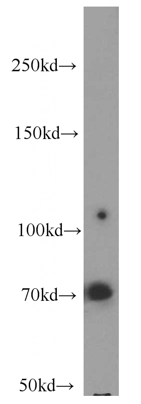 mouse brain tissue were subjected to SDS PAGE followed by western blot with Catalog No:111612(IDUA antibody) at dilution of 1:300