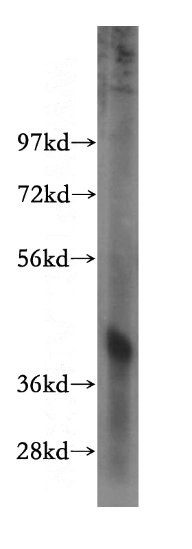 human liver tissue were subjected to SDS PAGE followed by western blot with Catalog No:113642(PDXK antibody) at dilution of 1:500