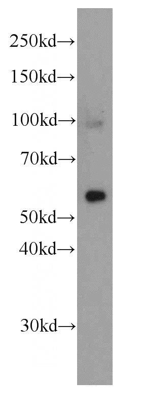 human brain tissue were subjected to SDS PAGE followed by western blot with Catalog No:107414(MAOB antibody) at dilution of 1:1000