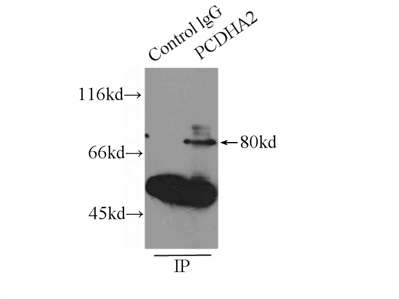 IP Result of anti-PCDHA2 (IP:Catalog No:113693, 3ug; Detection:Catalog No:113693 1:300) with HeLa cells lysate 4650ug.