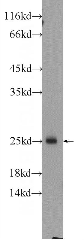 rat spleen tissue were subjected to SDS PAGE followed by western blot with Catalog No:114427(RAB27B Antibody) at dilution of 1:1000