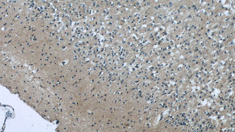Immunohistochemistry of paraffin-embedded human brain tissue slide using Catalog No:108157(ARMETL1 Antibody) at dilution of 1:50 (under 10x lens)
