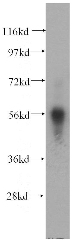 mouse skeletal muscle tissue were subjected to SDS PAGE followed by western blot with Catalog No:109475(CORO1C antibody) at dilution of 1:500
