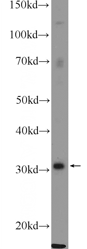 HeLa cells were subjected to SDS PAGE followed by western blot with Catalog No:107986(ALY Antibody) at dilution of 1:300