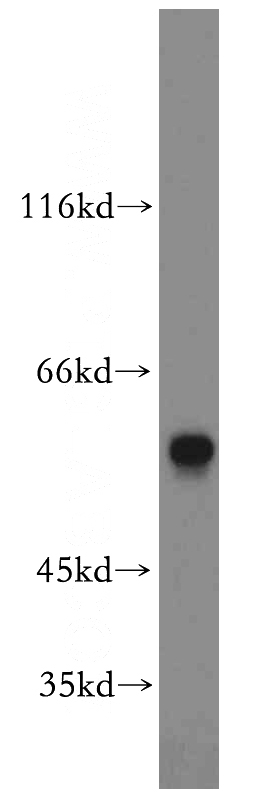 A375 cells were subjected to SDS PAGE followed by western blot with Catalog No:113967(PLK1 antibody) at dilution of 1:1000