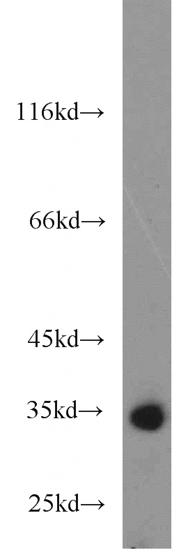 K-562 cells were subjected to SDS PAGE followed by western blot with Catalog No:114573(RCBTB1 antibody) at dilution of 1:200