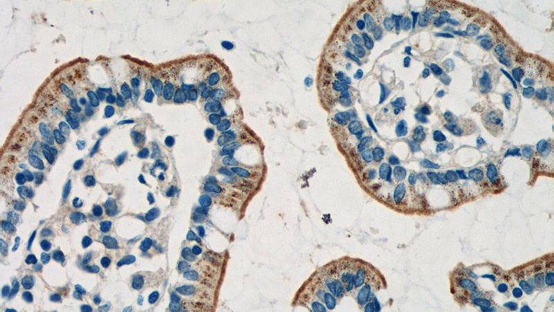 Immunohistochemistry of paraffin-embedded human small intestine tissue slide using Catalog No:111711(HTR3A Antibody) at dilution of 1:50 (under 40x lens)