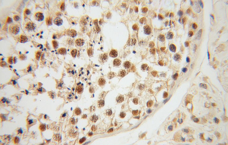 Immunohistochemical of paraffin-embedded human testis using Catalog No:115917(TCP10L antibody) at dilution of 1:50 (under 40x lens)