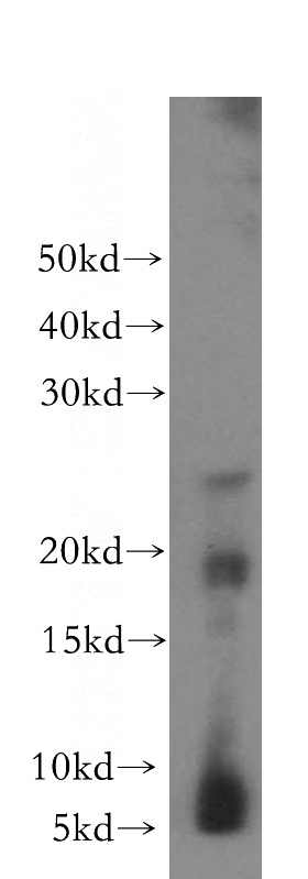 human brain tissue were subjected to SDS PAGE followed by western blot with Catalog No:109586(CRYGC antibody) at dilution of 1:500