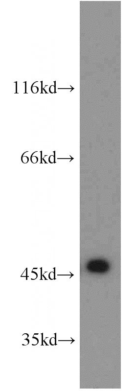 Jurkat cells were subjected to SDS PAGE followed by western blot with Catalog No:115205(SERPINB8 antibody) at dilution of 1:200
