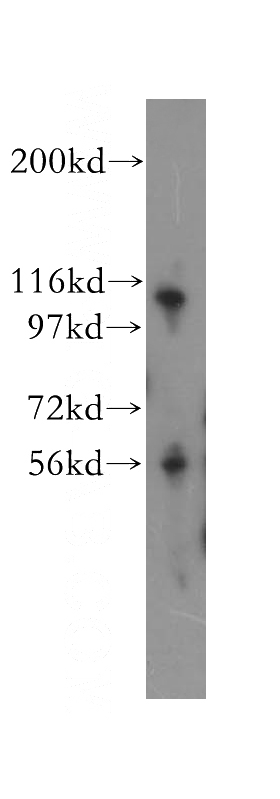SH-SY5Y cells were subjected to SDS PAGE followed by western blot with Catalog No:113492(SERPINE1 antibody) at dilution of 1:500