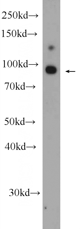 A549 cells were subjected to SDS PAGE followed by western blot with Catalog No:111155(GRAMD1B Antibody) at dilution of 1:1000