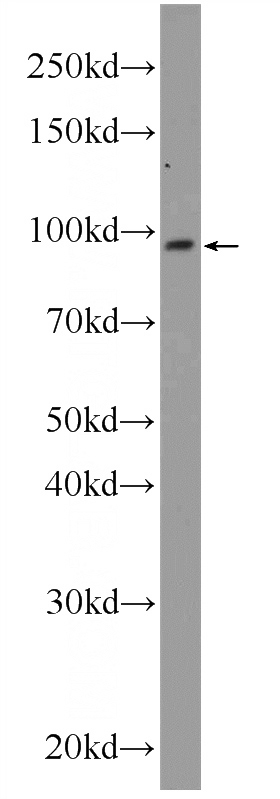 A549 cells were subjected to SDS PAGE followed by western blot with Catalog No:113995(POGK Antibody) at dilution of 1:600