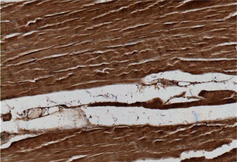 Immunohistochemistry of paraffin-embedded human skeletal muscle tissue slide using Catalog No:108875(Caspase 3 Antibody) at dilution of 1:50 (under 10x lens)