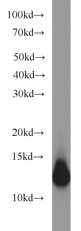 PC-3 cells were subjected to SDS PAGE followed by western blot with Catalog No:114955(S100A11 antibody) at dilution of 1:2000