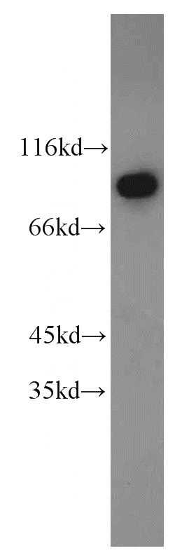 HeLa cells were subjected to SDS PAGE followed by western blot with Catalog No:109836(DDX50 antibody) at dilution of 1:800