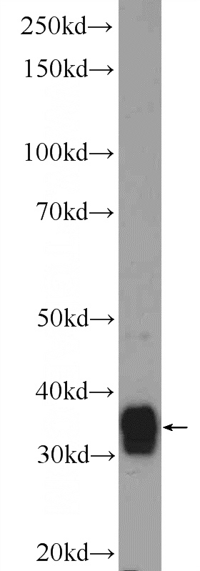 Jurkat cells were subjected to SDS PAGE followed by western blot with Catalog No:116382(TTC35 Antibody) at dilution of 1:600