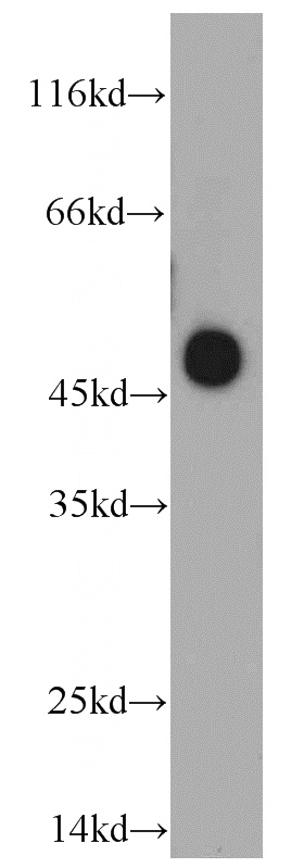 HepG2 cells were subjected to SDS PAGE followed by western blot with Catalog No:114351(NR1I2 antibody) at dilution of 1:200