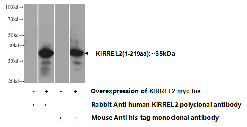 Transfected HEK-293 cells were subjected to SDS PAGE followed by western blot with Catalog No:112069(KIRREL2 Antibody) at dilution of 1:1000