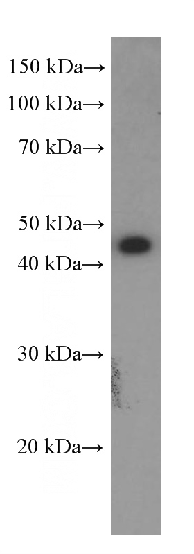 HEK-293 cells were subjected to SDS PAGE followed by western blot with Catalog No:107300(SLC2A1,GLUT1 Antibody) at dilution of 1:1500
